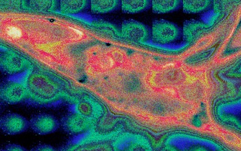 fluorescence imaging  showing a sell membrane covered a peptide believed to cause Alzheimer's